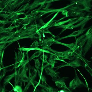 Protocol for cell transduction with Lentiviral Vectors