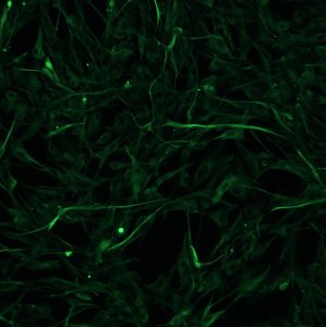 Optimized protocol for cell transduction with episomal LV