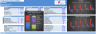 Private School Financial Model - 10+ Year DCF & Valuation