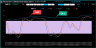 Stochastic Indicator – Technical Analysis – Stock Market Excel Template