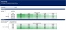 Real Estate - Hotel/Resort Development Excel Model Template
