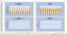Monte-Carlo Simulation - Forecast - Key Performance Indicators - Gold Mining Industry