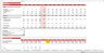 Interest Payments - Excel Model Template