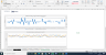 Due Diligence P&L - Exhaustive Revenue and Costs analysis template