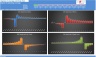 Degrees of Leverage and Break Even Point
